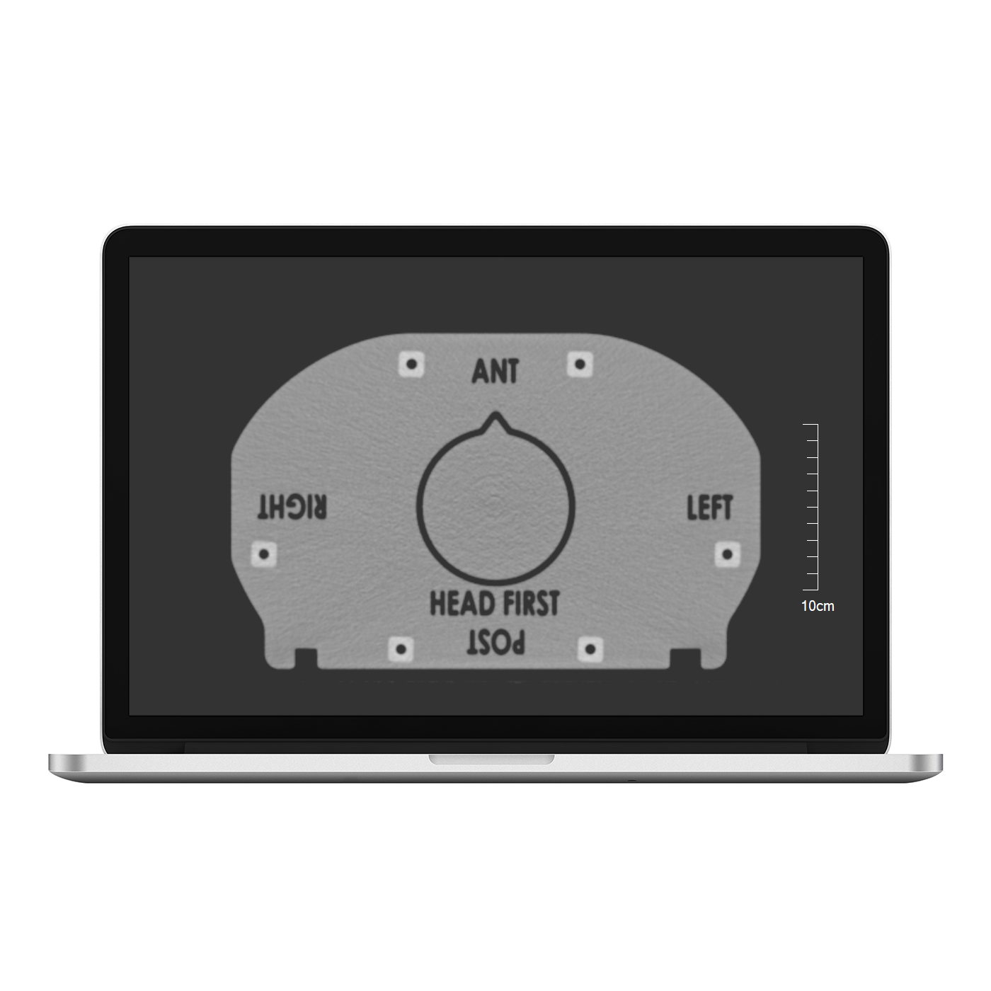 Thorx scan head 1400