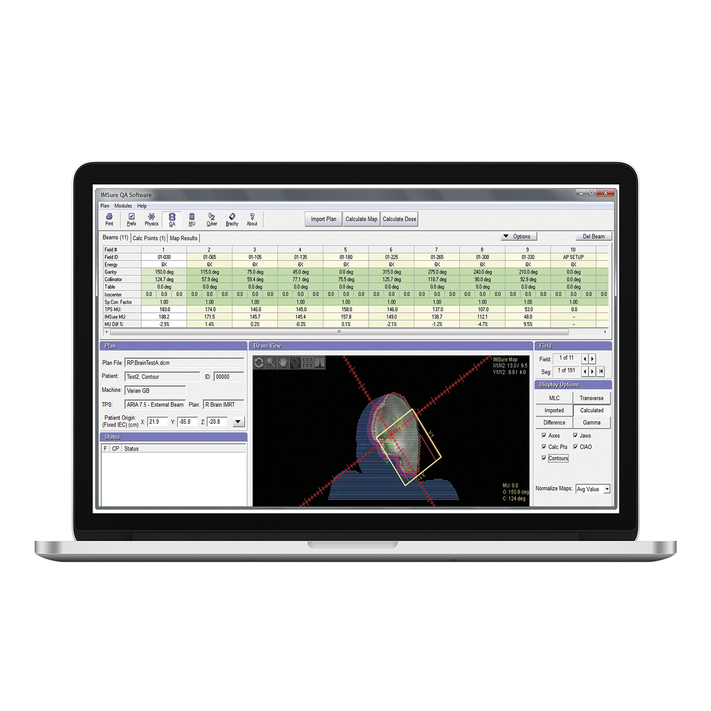 Imsure laptop 1400